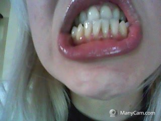 Very Ugly Teeth! Denti Orribili