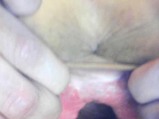 Teen gaping cunt_and showing cervix