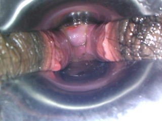 latina thot from new london has a beautiful cervix