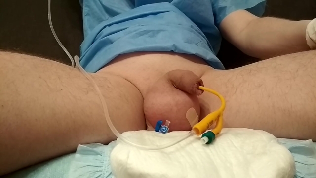 Saline Bladder Enema With Diaper Pornhubcom