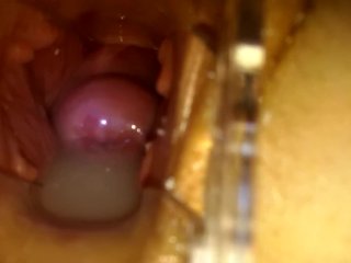 TabooHentai Schoolgirl_Fucked Inside A Gyno_Speculum FreckledRED