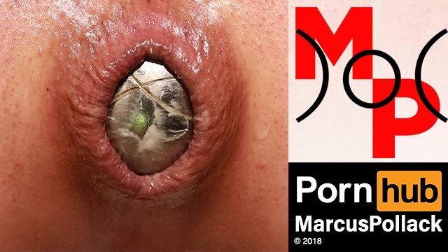 Anal Sex Birth - Extrem Close up Ass Birth - Pornhub.com