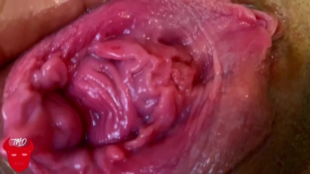 Tmd Explosive Farts And Prolapsed Pussy Fisting 7338