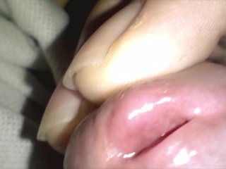 Closeup Glans
