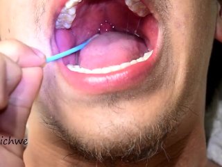 Touching The Uvula With Swabs