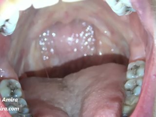 Dancing Uvula