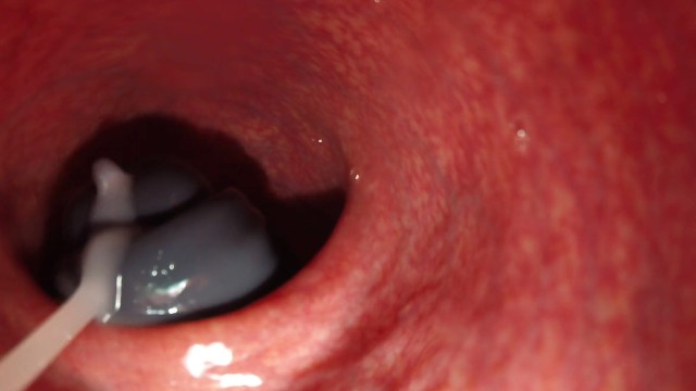 Sperm molar pregnancy - Internal camera bad dragon flint fucks and cums deep in my ass, lots of cum
