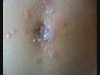 Torturing My Stepsister's Belly With Hot Wax And Massaging The Navel