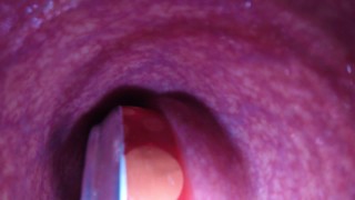 Deep Can Insertion For Internal Cameras