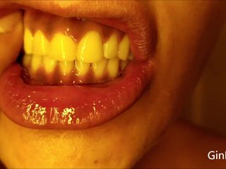 Mouth, Teeth, Tongue And Uvula Check