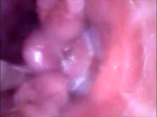 Spectulum In Pussy Und Von Innen Gefilmt Wie Es Mit Sperma Gefüllt Wird 1