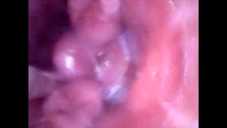 1 Spectulum In Pussy And Filmed From The Inside As It Is Filled With Sperma