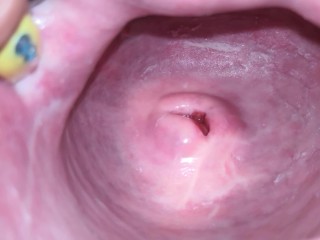 Screen Capture of Video Titled: Cervix close up [4k]