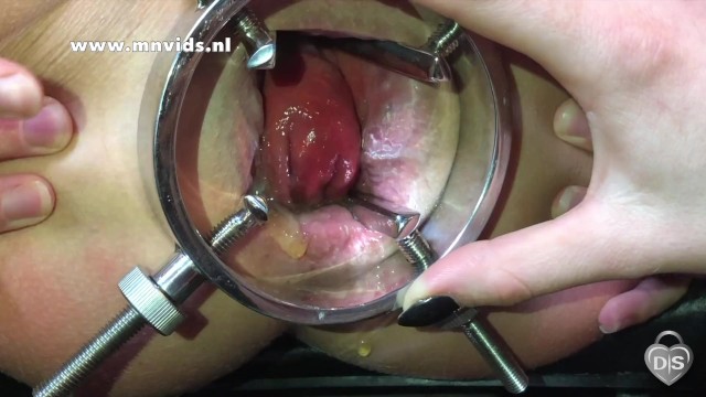 Anal gaping with an anal spreader