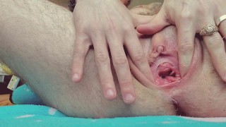 Part 1 Of The Transman Gaping Pussy Request