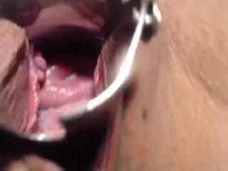 Speculum in my pussy and cervix show close_up