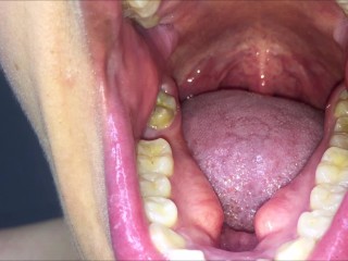 mouth exam in