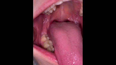 Tonsil Tongue Out Porn - Tongue, Tonsils, and Throat Examination - Pornhub.com