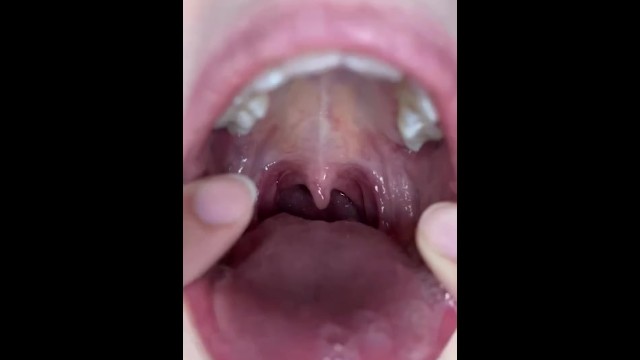 Porn Throat Tongue Out - Girl Mouth Uvula Tube - Porn Category | Free Porn Video | Page - 1