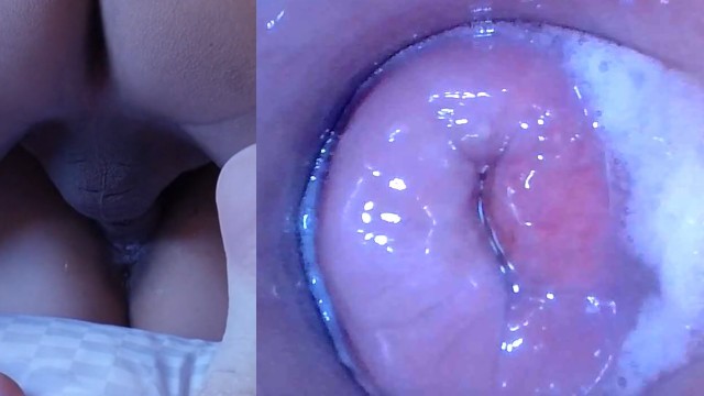 Intecourse Vagina Cam - Pussy Cum, Pussy Cam!! (Endoscope inside Creampied Pussy) - Pornhub.com