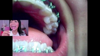 Endoscope Lila Jordan Mini Cam Vore Fetish Lila Jordan Mini Cam Vore Fetish Lila Jordan Mini Cam Vore Fetish Lila Jordan