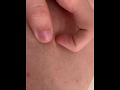 Naked pimple popping