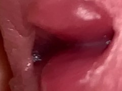 Tongue In Urethra Porn - Endoscope Urethra Videos and Gay Porn Movies :: PornMD