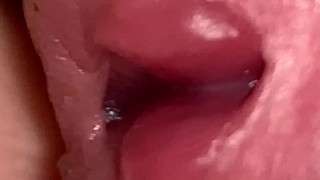 Virgin Urinary Examination
