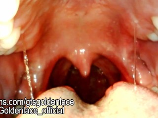 Gummy vore with endo cam