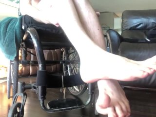 Pasty White Numb Legs Of A Paraplegic