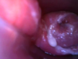Play With Speculum And View Inside My Pussy By Inside Camera