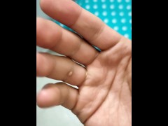 Veins of my hand