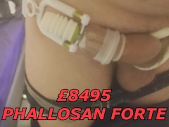 £8495 for Penis Enlargement Surgery Part 2 / Тhey sent me Phallosan Forte