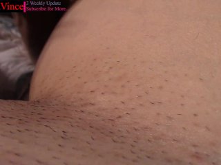 This Is My Biggest Fetish... Girls Would You GetYYour Ingrown Hairs_Removed By Me?