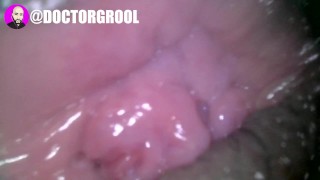 Petite Doctor Endoscope Video Inspecting Creamy Vagina