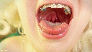 Braces Closeup Vore Fetish Tongue Saliva Braces Mouth Tour Video