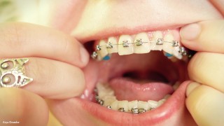 Mouth Food Fetish Vore Video Mouth Tour Eating In Braces