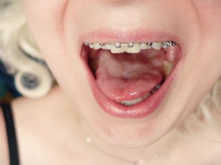 Giantess_Vore Fetish - FemDom POV - braces_mouth tour close up