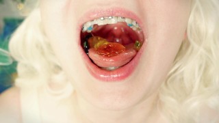 Braces BRACES ASMR Video Jelly Candy FOOD FETISH With Close Up Sounds