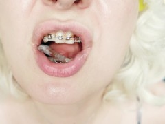 braces fetish: close up video mukbang