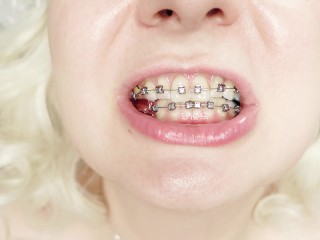 braces fetish: close up video mukbang jelly_candy