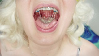 Braces Close-Up Video Of Braces Fetish Mukbang Tasty Ice-Cream