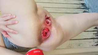 Extreme Anal Gape EXTREME ANAL INSERTIONS IN PUBLIC PLAY ANAL FISTING PLAY WITH A COKE CAN