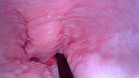 Internal Anal Warts - Inside Vagina Vore Porn Videos | Pornhub.com